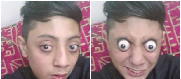 Conheça o jovem que pode estourar seus olhos para fora Conheça o jovem que pode estourar seus olhos para fora