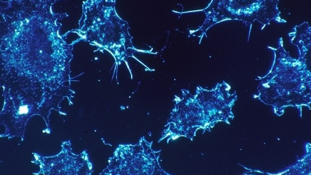 Scansione delle cellule tumorali