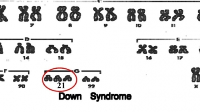 7.5% dei concepimenti 50% degli aborti spontanei 0.7% dei nati ... - slideplayer.it