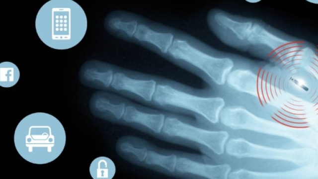 France Info : Les « Implants parties » _ Les implants NFC arrive ... - iatranshumanisme.com