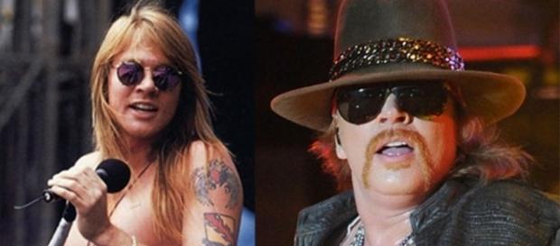 O antes e o depois de Axl Rose O antes e o depois de Axl Rose