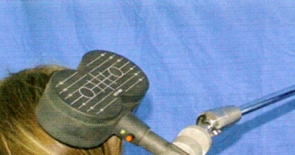 Stimulation magnétique, effets spectaculaires contre la dépression
