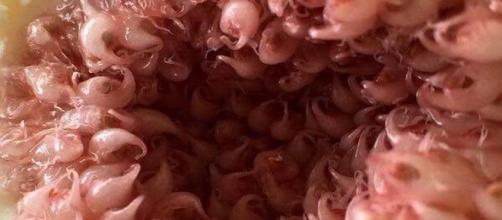Canal vaginal visto microscopicamente.