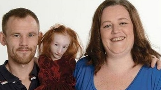 Charlotte Garside elle est la plus petite fille au monde !