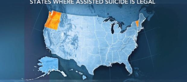 What's the state of assisted suicide laws across the U.S.? | PBS ... - pbs.org What's the state of assisted suicide laws across the U.S.? | PBS ... - pbs.org