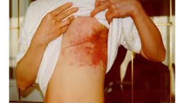 Il carcinoma mammario Dr. Giuseppe Fariselli Studio Medico, via G ... - slideplayer.it