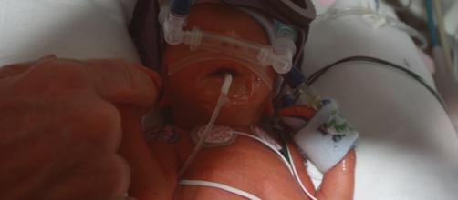 The challenges for premature babies. Image source:myleftbehind.files.wordpress.com