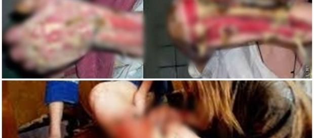 Droga causa vários danos físicos e mentais Droga causa vários danos físicos e mentais
