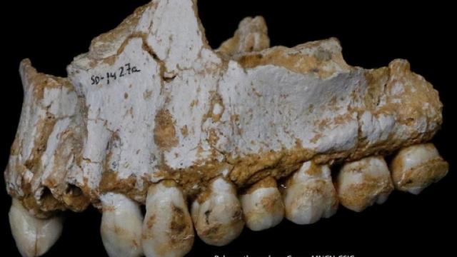 Il tartaro dentale di questo campione riporta tracce di fungo Penicillium ed acido salicilico.