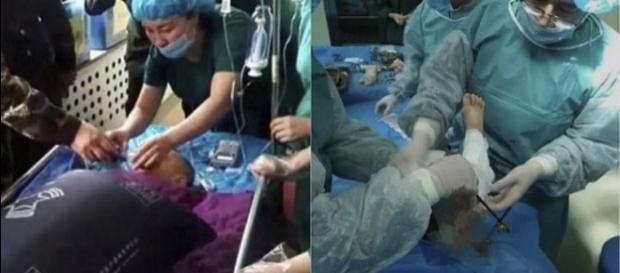 Mãe cortou a perna do próprio filho na China após surtar com o garoto. Mãe cortou a perna do próprio filho na China após surtar com o garoto.