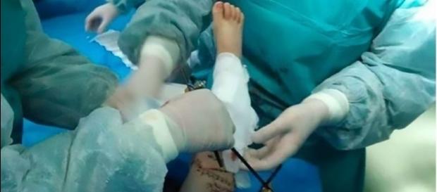 Depois da cirurgia, menino ainda está nos cuidados intensivos Depois da cirurgia, menino ainda está nos cuidados intensivos