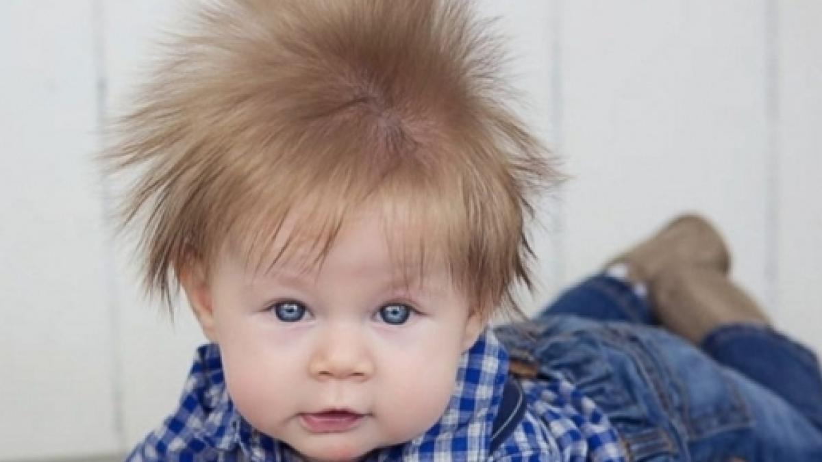 Bebe De Cinco Meses Tem Cabelo Que Lhe Da A Aparencia De Ter Sido Eletrocutado