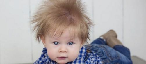 Bebê de cinco meses tem cabelo que lhe dá a aparência de ter sido eletrocutado