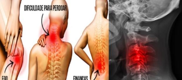 Dores do corpo podem estar ligadas ao estado emocional Dores do corpo podem estar ligadas ao estado emocional