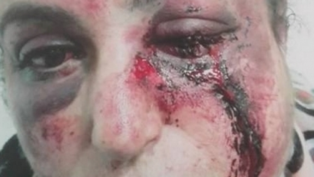 CHOC : Fatna, tabassée par son mari après un mariage refusé