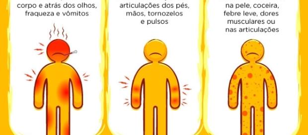 Diferentes sintomas da Dengue, Chikungunya e Zika Diferentes sintomas da Dengue, Chikungunya e Zika