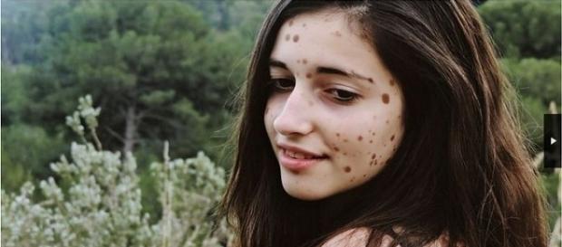 Garota conseguiu trabalho de modelo por ser diferente das outras pessoas Garota conseguiu trabalho de modelo por ser diferente das outras pessoas