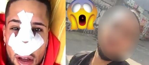 Eddy a beaucoup souffert après l'opération Eddy a beaucoup souffert après l'opération