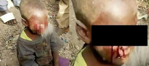 Madrasta arranca olhos de criança - Google Madrasta arranca olhos de criança - Google