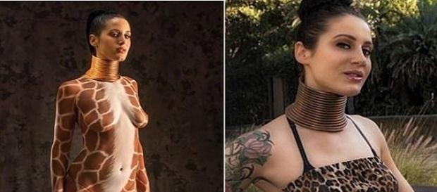 Mulher girafa abandonou tratamento para esticar o pescoço após cinco anos Mulher girafa abandonou tratamento para esticar o pescoço após cinco anos