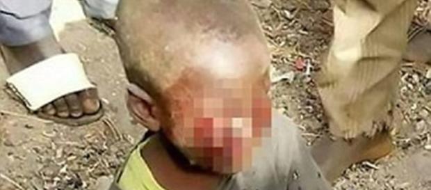 Madrasta arranca olhos de enteado como castigo Madrasta arranca olhos de enteado como castigo