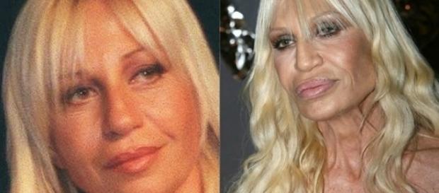 Donatella Versace está na lista de mulheres que arruinaram seu rosto. Donatella Versace está na lista de mulheres que arruinaram seu rosto.