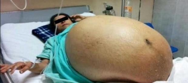 Mulher nota algo gigante crescendo em sua barriga - Google Mulher nota algo gigante crescendo em sua barriga - Google