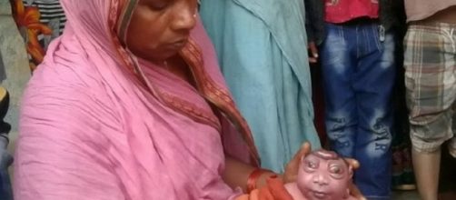 India, il bimbo 'alieno' sconvolge madre e abitanti