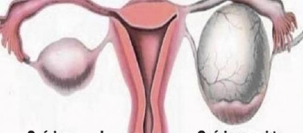 Importante estar atento aos sinais do corpo Importante estar atento aos sinais do corpo