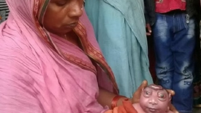 India, il bimbo 'alieno' sconvolge madre e abitanti