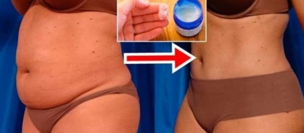 Creme a base de Vick Vaporub ajuda a eliminar as gorduras localizadas Creme a base de Vick Vaporub ajuda a eliminar as gorduras localizadas