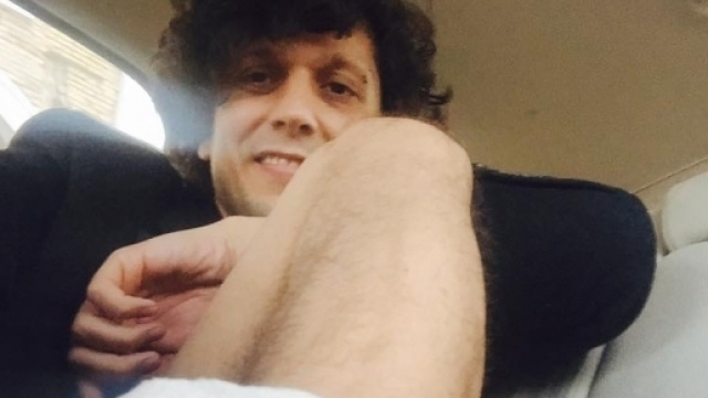 Ermal Meta pubblica la foto dell'infortunio su Facebook