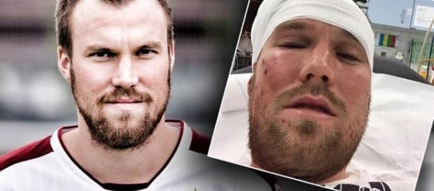 Kevin Großkreutz: Nach einer Schlägerei Montagnacht in Stuttgart. Kevin Großkreutz: Nach einer Schlägerei Montagnacht in Stuttgart.