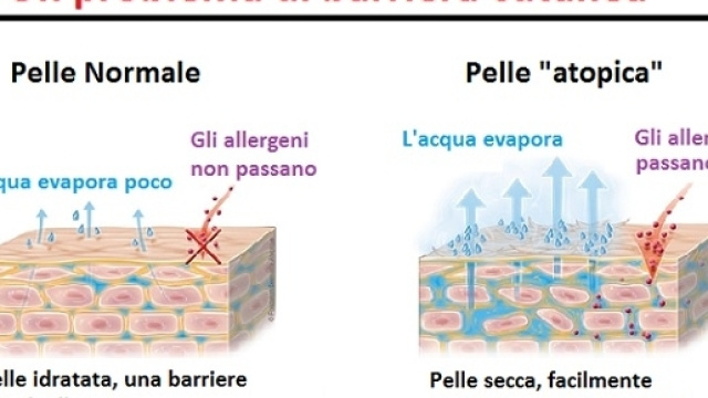 Una pelle ben idratata è la prima barriera agli attacchi dagli agenti esterni