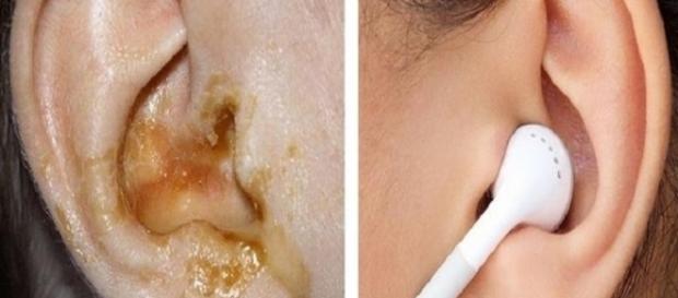 Jamais compartilhe essas 7 coisas com outra pessoa ou você pode vir a ter doenças graves Jamais compartilhe essas 7 coisas com outra pessoa ou você pode vir a ter doenças graves