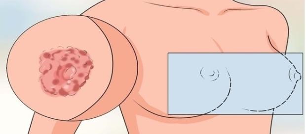 Se você apresentou esses sintomas, o ideal é procurar um médico imediatamente Se você apresentou esses sintomas, o ideal é procurar um médico imediatamente