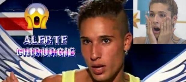 Eddy n'en est pas à sa première opération de chirurgie esthétique Eddy n'en est pas à sa première opération de chirurgie esthétique