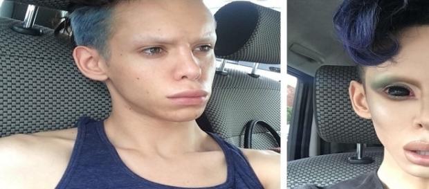 Esse garoto gastou milhares de reais para ficar parecido com um alien Esse garoto gastou milhares de reais para ficar parecido com um alien