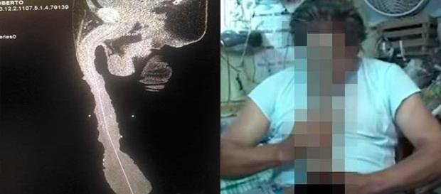 O mexicano possui o maior membro sexual do mundo O mexicano possui o maior membro sexual do mundo