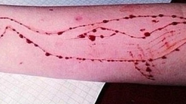 Blue Whale, il raccapricciante gioco che ha già portato alla morte 130 adolescenti