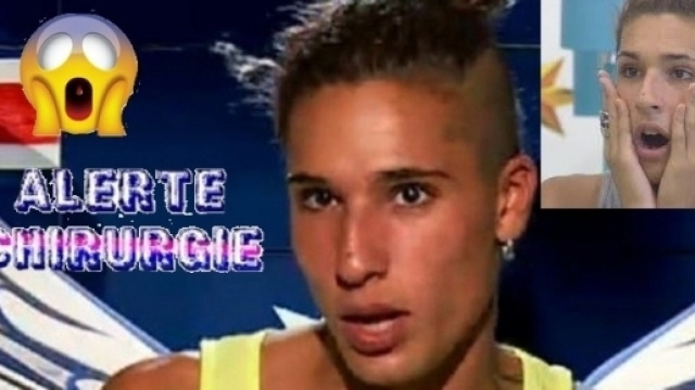 Eddy n'en est pas à sa première opération de chirurgie esthétique