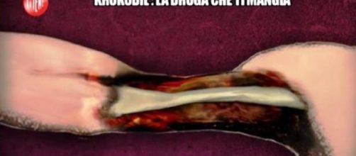 Krokodil, la droga russa che ti mangia la carne