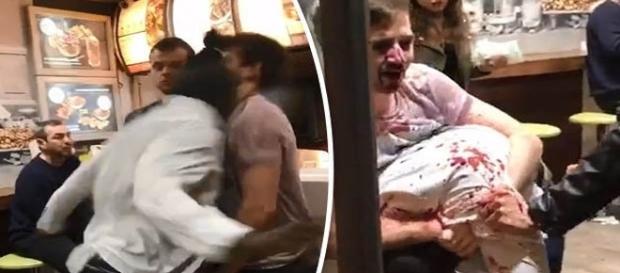 Homem agride vítima com violenta cabeçada no rosto (Daily Star via DEADLINE) Homem agride vítima com violenta cabeçada no rosto (Daily Star via DEADLINE)