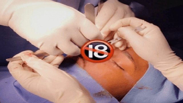 Eddy se faire opérer d'une rhinoplastie en Tunisie