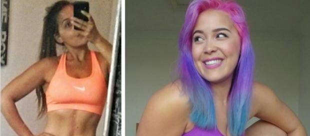 Anorexia Survivor Shows How Gaining Weight Improved Life - Motto - time.com Anorexia Survivor Shows How Gaining Weight Improved Life - Motto - time.com
