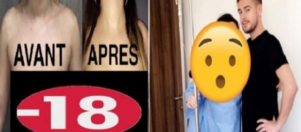 Jazz en Tunisie : avant / après la chirurgie esthétique... Jazz en Tunisie : avant / après la chirurgie esthétique...