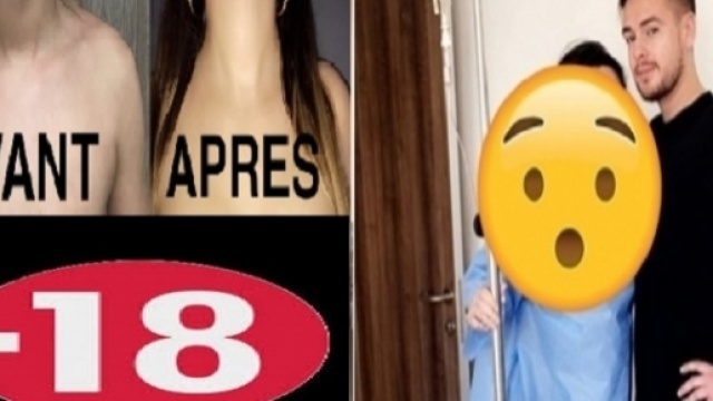 Jazz en Tunisie : avant / après la chirurgie esthétique...