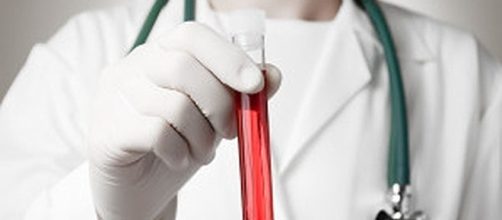 Test del sangue per la diagnosi precoce dei tumori: la nuova scoperta.