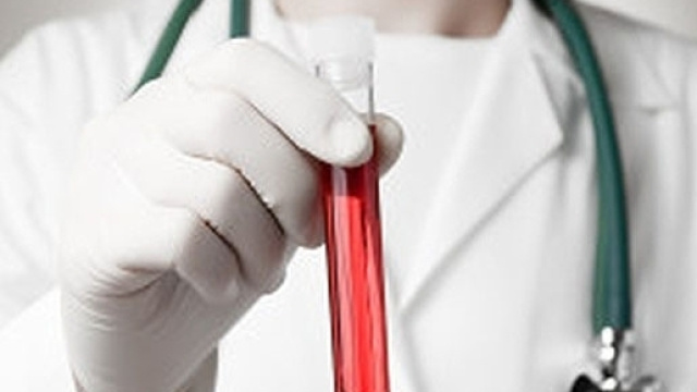 Test del sangue per la diagnosi precoce dei tumori: la nuova scoperta.