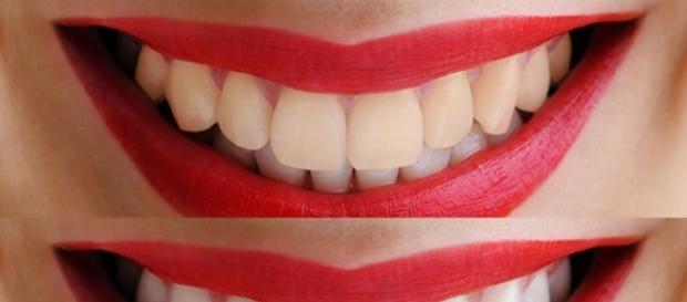Dientes más blancos con ingredientes naturales Dientes más blancos con ingredientes naturales